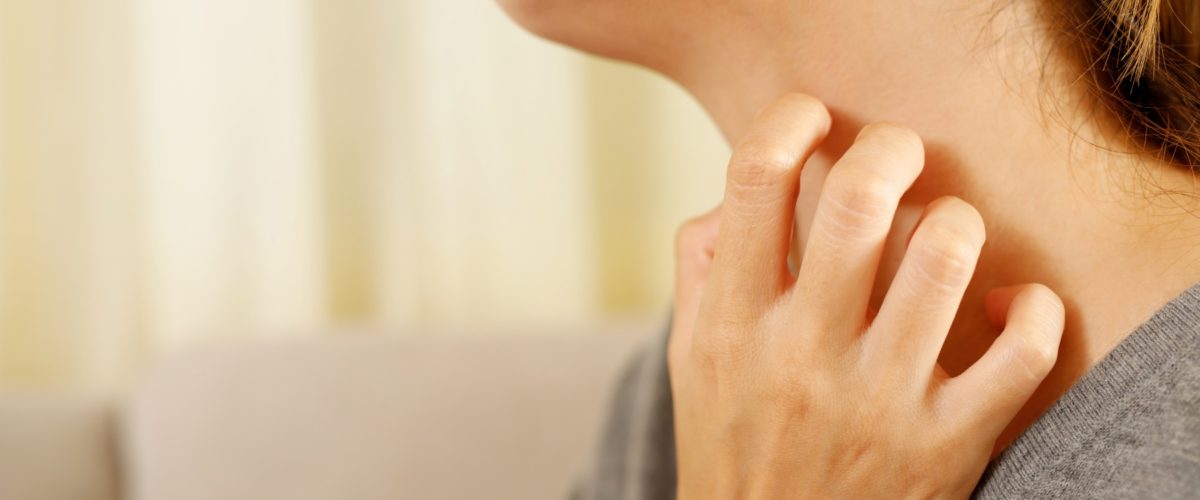 O que é dermatite atópica e como tratá-la?