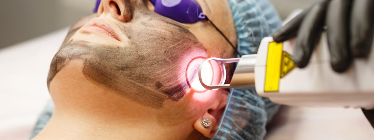 Laser para manchas: como funciona e quais os melhores tipos para cada pele 