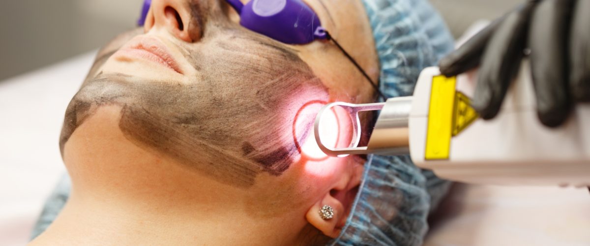 Laser para manchas: como funciona e quais os melhores tipos para cada pele 